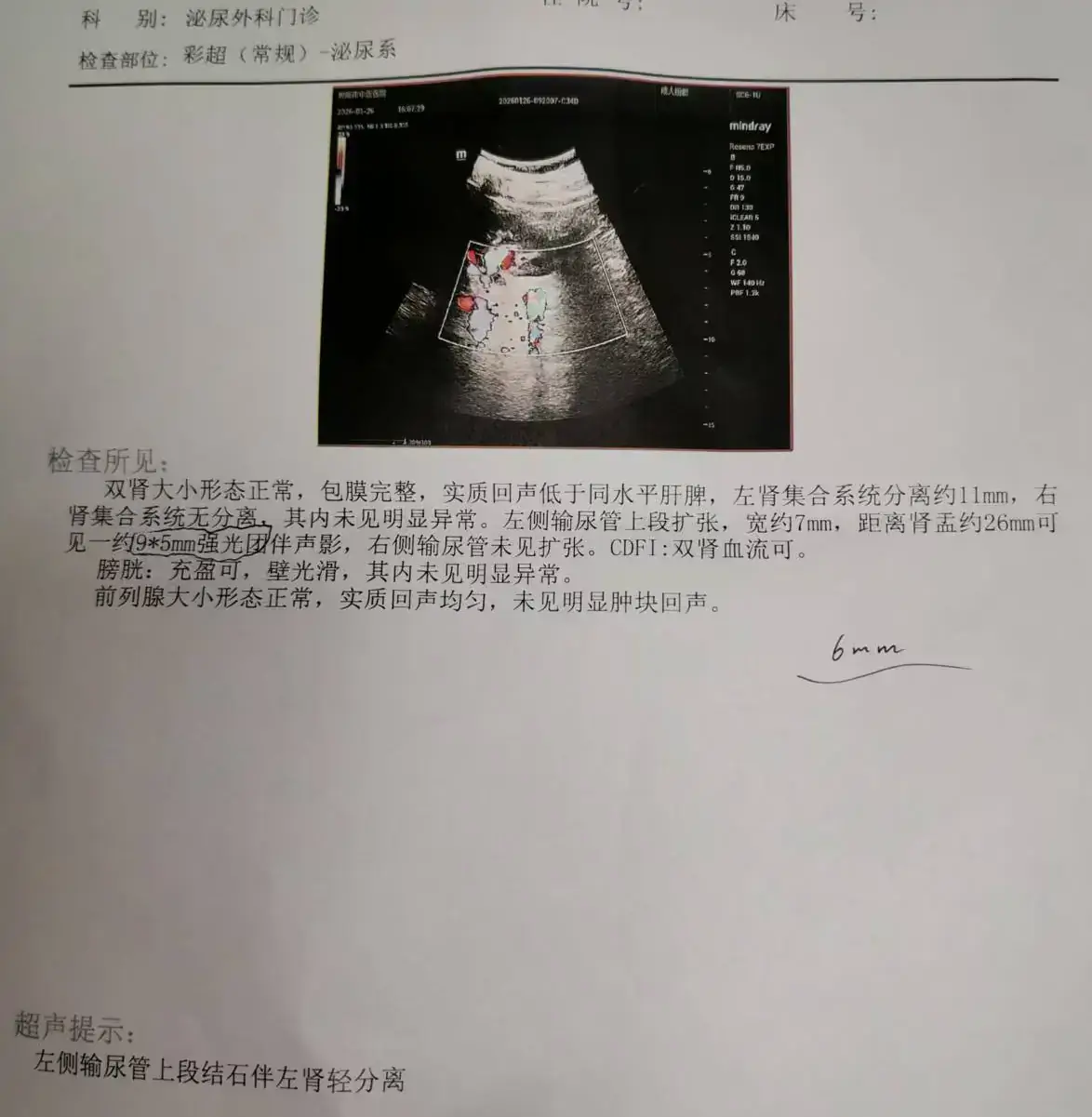 肾结石手术治疗记录